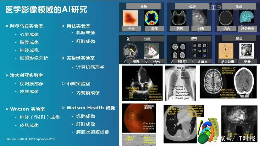 ibm watson_IBM Watson Health解决方案_AI助力智慧医疗新未来